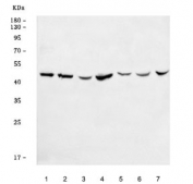 Western blot testing of 1) human 293T, 2) human HeLa, 3) human U-87 MG, 4) human HaCaT, 5) rat testis, 6) rat brain and 7) mouse brain tissue lysate with Seipin antibody. Predicted molecular weight ~44 kDa.