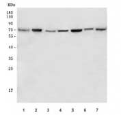 Western blot testing of human 1) 293T, 2) Caco-2, 3) MOLT4, 4) Raji, 5) HeLa, 6) HaCaT and 7) SiHa cell lysate with M-phase inducer phosphatase 2 antibody. Expected molecular weight: 61~67 kDa (isoforms 1-4).