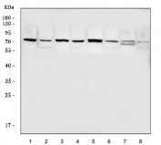 Western blot testing of 1) rat liver, 2) rat brain, 3) rat kidney, 4) rat testis, 5) mouse liver, 6) mouse brain, 7) mouse kidney and 8) mouse testis tissue lysate with M-phase inducer phosphatase 2 antibody. Expected molecular weight: 61~67 kDa (isoforms 1-4).