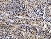 IHC staining of FFPE human spleen tissue with CEP250 antibody. HIER: boil tissue sections in pH8 EDTA for 20 min and allow to cool before testing.
