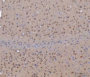 IHC staining of FFPE mouse brain tissue with CEP250 antibody. HIER: boil tissue sections in pH8 EDTA for 20 min and allow to cool before testing.