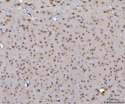 IHC staining of FFPE rat brain tissue with CEP250 antibody. HIER: boil tissue sections in pH8 EDTA for 20 min and allow to cool before testing.