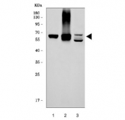 Western blot testing of 1) human HepG2, 2) human HCCP and 3) mouse liver tissue lysate with CES2 antibody. Predicted molecular weight ~62 kDa.