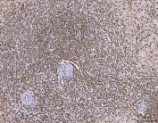 IHC staining of FFPE human spleen tissue with CHTOP antibody. HIER: boil tissue sections in pH8 EDTA for 20 min and allow to cool before testing.