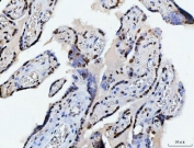 IHC staining of FFPE human placental tissue with CHTOP antibody. HIER: boil tissue sections in pH8 EDTA for 20 min and allow to cool before testing.