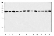 Western blot testing of 1) human HeLa, 2) monkey COS-7, 3) human ThP-1, 4) human MOLT-4, 5) human RT4, 6) human HL-60, 7) human MCF-7, 8) rat brain, 9) rat PC-12, 10) mouse spleen, 11) mouse brain, 12) mouse lung and 12) mouse L929 cell lysate with CHTOP antibody. Predicted molecular weight ~26 kDa.