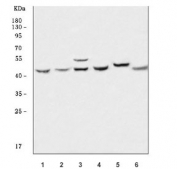 Western blot testing of 1) human Raji, 2) human MOLT4, 3) human HeLa, 4) rat brain, 5) mouse brain and 6) mouse lung tissue lysate with MDR15 antibody. Predicted molecular weight ~43 kDa.