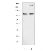 Western blot testing of human 1) RT4 and 2) MCF7 cell lysate with DNM2 antibody. Predicted molecular weight ~98 kDa.