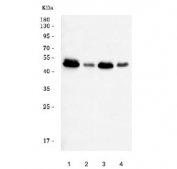 Western blot testing of human 1) HeLa, 2) Raji, 3) K562 and 4) T-47D cell lysate with E2F5 antibody. Predicted molecular weight ~38 kDa but may be observed at higher molecular weights due to phosphorylation.