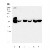 Western blot testing of 1) human HCCP, 2) human HepG2, 3) rat liver, 4) rat kidney, 5) mouse liver and 6) mouse kidney tissue lysate with Fumarylacetoacetate hydrolase antibody. Predicted molecular weight: 39-46 kDa (two isoforms).