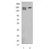 Western blot testing of 1) rat testis and 2) mouse thymus tissue lysate with Fanca antibody. Predicted molecular weight ~161 kDa.