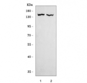 Western blot testing of human 1) MCF-7 and 2) HeLa cell lysate with FGFR2 antibody. Predicted molecular weight of multiple isoforms: 80-120 kDa. The observed size may be larger due to glycosylation.