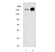 Western blot testing of human 1) HeLa and 2) SH-SY5Y cell lysate with Insulin receptor substrate 2 antibody. Predicted molecular weight ~137 kDa but it may be observed at up to ~190 kDa due to phosphorylation.