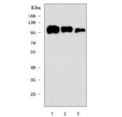 Western blot testing of 1) human U-87 MG, 2) human HEL and 3) rat spleen lysate with CD61 antibody. Expected molecular weight: 87-110 kDa depending on glycosylation level.