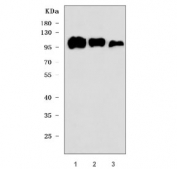 Western blot testing of 1) human U-87 MG, 2) human HEL and 3) rat spleen lysate with CD61 antibody. Expected molecular weight: 87-110 kDa depending on glycosylation level.
