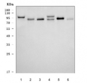 Western blot testing of 1) human 293T, 2) human HeLa, 3) human placenta, 4) rat testis, 5) rat H9c2(2-1) cells and 6) mouse testis tissue lysate with MCM8 antibody. Expected molecular weight ~94/89 kDa (isoforms 1/2).