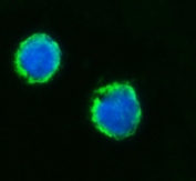 Immunofluorescent staining of FFPE human SiHa cells with Mitochondrial fission factor antibody (green) and DAPI nuclear stain (blue). HIER: steam section in pH6 citrate buffer for 20 min.