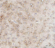 IHC staining of FFPE mouse brain tissue with Mitochondrial fission factor antibody. HIER: boil tissue sections in pH8 EDTA for 20 min and allow to cool before testing.