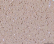 IHC staining of FFPE rat brain tissue with Mitochondrial fission factor antibody. HIER: boil tissue sections in pH8 EDTA for 20 min and allow to cool before testing.