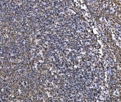 IHC staining of FFPE human tonsil tissue with MRE11 antibody. HIER: boil tissue sections in pH8 EDTA for 20 min and allow to cool before testing.