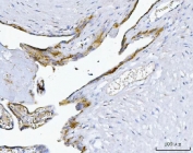 IHC staining of FFPE human placental tissue with MTSS1 antibody. HIER: boil tissue sections in pH8 EDTA for 20 min and allow to cool before testing.