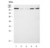 Western blot testing of 1) human Jurkat, 2) human placenta, 3) rat spleen, 4) rat thymus and 5) mouse thymus tissue lysate with MTSS1 antibody. Predicted molecular weight ~82 kDa but can be observed at 90-115 kDa.