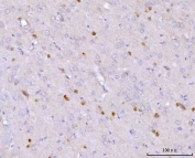 IHC staining of FFPE rat brain tissue with NOS1AP antibody. HIER: boil tissue sections in pH8 EDTA for 20 min and allow to cool before testing.