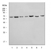 Western blot testing of 1) human 293T, 2) human HeLa, 3) human placenta, 4) human U-87 MG, 5) human A431, 6) rat heart and 7) mouse NIH 3T3 cell lysate with AMPK gamma 2 antibody. Predicted molecular weight ~63 kDa.