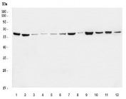 Western blot testing of 1) monkey COS-7, 2) human HeLa, 3) human MOLT-4, 4) human Jurkat, 5) human HEL, 6) human Daudi, 7) human A431, 8) human T-47D, 9) rat brain, 10) rat pancreas, 11) mouse brain and 12) mouse pancreas tissue lysate with RAD21 antibody. Expected molecular weight: ~120 kDa (full length), 64-70 kDa (cleavage product).