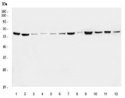 Western blot testing of 1) monkey COS-7, 2) human HeLa, 3) human MOLT-4, 4) human Jurkat, 5) human HEL, 6) human Daudi, 7) human A431, 8) human T-47D, 9) rat brain, 10) rat pancreas, 11) mouse brain and 12) mouse pancreas tissue lysate with RAD21 antibody. Expected molecular weight: ~120 kDa (full length), 64-70 kDa (cleavage product).