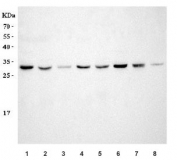 Western blot testing of human 1) A431, 2) HepG2, 3) A549, 4) PC-3, 5) K562, 6) A431, 7) SW620 and 8) Raji cell lysate with SNAI1 antibody. Predicted molecular weight ~29 kDa.
