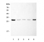 Western blot testing of 1) rat RH35, 2) mouse liver, 3) mouse lung, 4) mouse heart and 5) mouse HEPA1-6 cell lysate with SNAI1 antibody. Predicted molecular weight ~29 kDa.