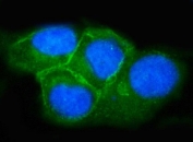 Immunofluorescent staining of FFPE human T-47D cells with Synaptosomal-associated protein 23 antibody (green) and DAPI nuclear stain (blue). HIER: steam section in pH6 citrate buffer for 20 min.