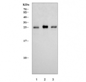 Western blot testing of human 1) HepG2, 2) HEL and 3) HeLa cell lysate with Synaptosomal-associated protein 23 antibody. Expected molecular weight: ~23/18 kDa (isoforms 1/2).
