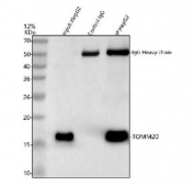 Immunoprecipitation of TOMM20 protein from 500ug of human HepG2 whole cell lysate with 2ug of TOMM20 antibody.