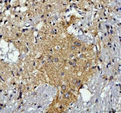 IHC staining of FFPE rat brain tissue with TOMM20 antibody. HIER: boil tissue sections in pH8 EDTA for 20 min and allow to cool before testing.