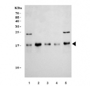 Western blot testing of human 1) 293T, 2) HepG2, 3) HeLa, 4) SH-SY5Y and 5) HL60 cell lysate with TOMM20 antibody. Predicted molecular weight ~16 kDa.