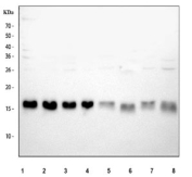 Western blot testing of 1) human HepG2, 2) human 293T, 3) human K562, 4) human HeLa, 5) rat brain, 6) rat kidney, 7) mouse brain and 8) mouse kidney tissue lysate with TOMM20 antibody. Predicted molecular weight ~16 kDa.
