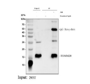 Immunoprecipitation of TOMM20 protein from 500ug of human 293T whole cell lysate with 2ug of TOMM20 antibody.