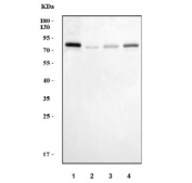 Western blot testing of human 1) placenta, 2) PC-3, 3) HepG2 and 4) HGC-27 cell lysate with TRPV6 antibody. Predicted molecular weight ~87 kDa (isoform 1) and ~68 kDa (isoform 2).