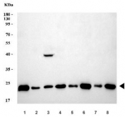 Western blot testing of 1) human SH-SY5Y, 2) human HeLa, 3) human T-47D, 4) human SiHa, 5) rat ovary, 6) rat PC-12, 7) mouse ovary and 8) mouse NIH 3T3 cell lysate with BBS8 antibody. Expected molecular weight: 55-62 kDa (multiple isoforms) + a ~29 kDa isoform.