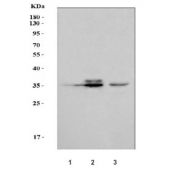 Western blot testing of human 1) placenta, 2) 293T and 3) Jurkat cell lysate with XIAP associated factor 1 antibody. Predicted molecular weight ~34 kDa.