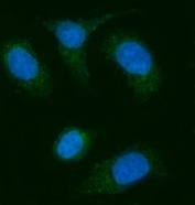 Immunofluorescent staining of FFPE human SiHa cells with Alkyl-DHAP synthase antibody (green) and DAPI nuclear stain (blue). HIER: steam section in pH6 citrate buffer for 20 min.