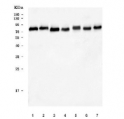 Western blot testing of human 1) HeLa, 2) K562, 3) HepG2, 4) RT4, 5) HEL, 6) Caco-2 and 7) SiHa cell lysate with Alkyl-DHAP synthase antibody. Predicted molecular weight ~73 kDa.