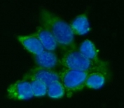 Immunofluorescent staining of FFPE human HepG2 cells with ATP5A1 antibody (green) and DAPI nuclear stain (blue). HIER: steam section in pH6 citrate buffer for 20 min.