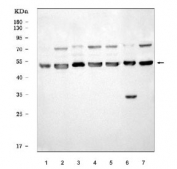 Western blot testing of human 1) SK-OV-3, 2) MCF7, 3) HL60, 4) RT4, 5) Daudi, 6) ThP-1 and 7) HepG2 cell lysate with ATP5A1 antibody. Predicted molecular weight ~54-60 kDa (multiple isoforms).