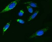 Immunofluorescent staining of FFPE human PC-3 cells with ATP5F1B antibody (green) and DAPI nuclear stain (blue). HIER: steam section in pH6 citrate buffer for 20 min.