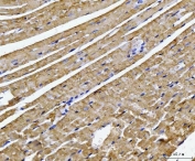 IHC staining of FFPE mouse heart tissue with ATP5F1B antibody. HIER: boil tissue sections in pH6, 10mM citrate buffer, for 20 min and allow to cool before testing.