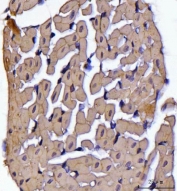 IHC staining of FFPE rat heart tissue with ATP5F1B antibody. HIER: boil tissue sections in pH6, 10mM citrate buffer, for 20 min and allow to cool before testing.