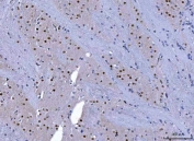 IHC staining of FFPE rat brain tissue with CHD1 antibody. HIER: boil tissue sections in pH8 EDTA for 20 min and allow to cool before testing.